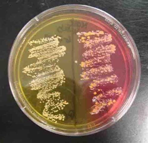 staphylococcus bacteria  images photographs  science prof