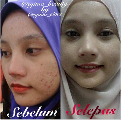 Review natasha skin care, nmw skin care review, no 7 skincare review, neutrogena skin care review, nadasutra skincare review assalamuallaikum sahabat beauty. Syma Beauty Skincare - Syiela