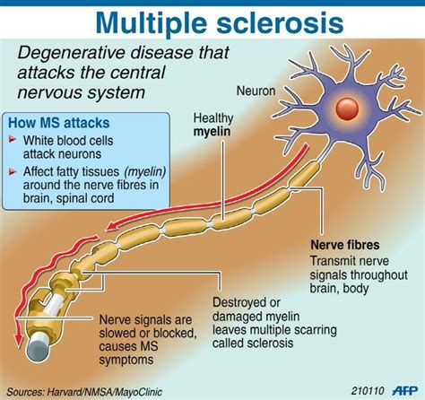 Multiple sclerosis (ms) is an autoimmune disease in which the body's immune system attacks its own central nervous system (the brain and spinal cord). Gene study confirms low Vitamin D, multiple sclerosis link ...