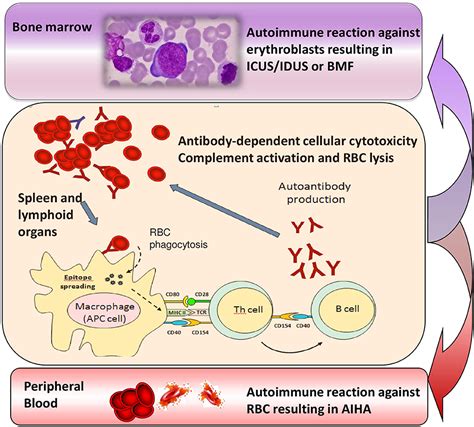 Frontiers The Changing Landscape Of Autoimmune Hemolytic Anemia