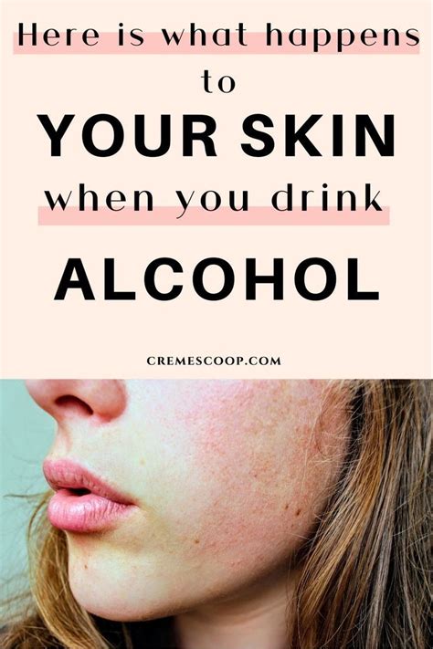 5 Damaging Effects Of Alcohol On Skin And Your Appearance Get Rid Of Eczema Skin Skin Disorders