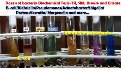 Various Bacteria Biochemical Tests E Coli Klebsiellapseudomonas