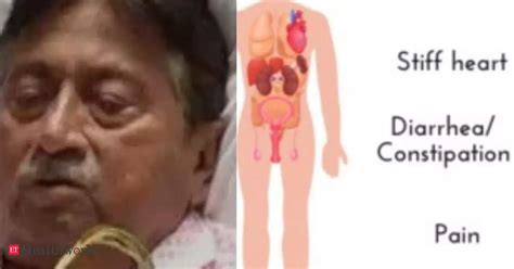 Former Pakistan President Pervez Musharraf Died Battling ‘amyloidosis A Rare Disease Health