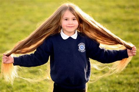 Real Life Rapunzel Treatment For Rare Illness Causes Girls Hair To