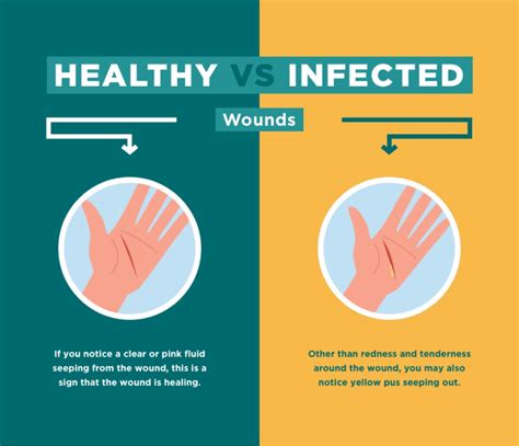 How Do You Know If A Wound Is Infected