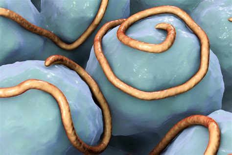 Worms In Humans Nidirect
