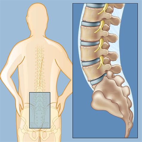 Low Back Pain Detail And Physiotherapy Treatment