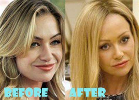portia de rossi plastic surgery before and after nose job lovely surgery