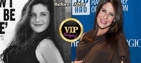 Soleil Moon Frye Before Surgery Pictures