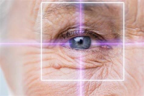 Das Buch Zur Augenakupunktur Als Therapie Bei Makuladegeneration