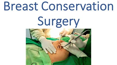 Breast Conservation Surgery Breast Cancer Operative Surgery Youtube
