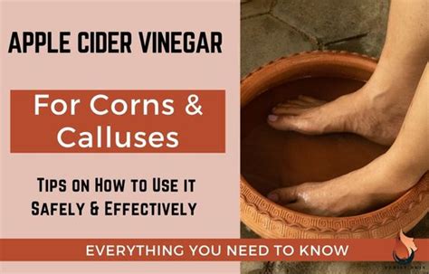 Apple Cider Vinegar For Corns And Calluses What To Know Verily Skin