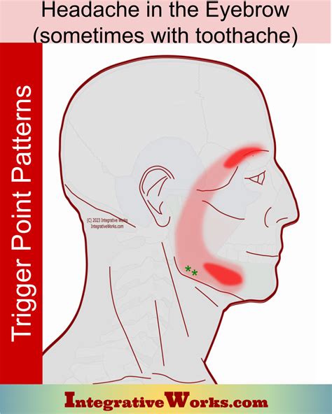 Headache In The Eyebrow Integrative Works