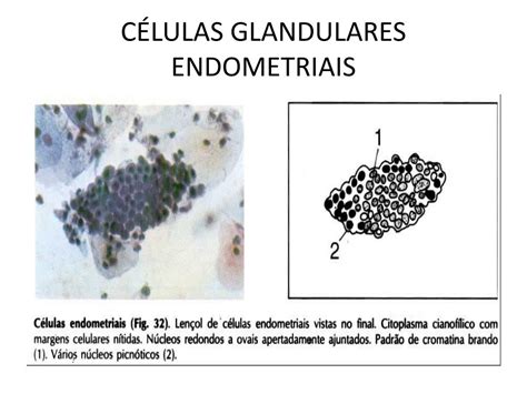 Elementos Da Zona De Transformação / Células Glandulares Endocervicais Presentes