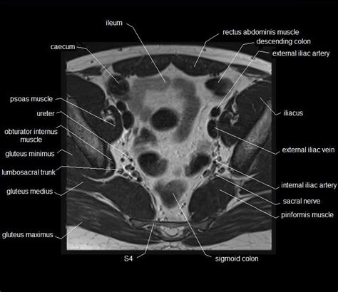 Abdominal and pelvic anatomy encompasses the anatomy of all structures of the abdominal and pelvic cavities. MRI pelvis anatomy | free male pelvis axial anatomy | MRI ...