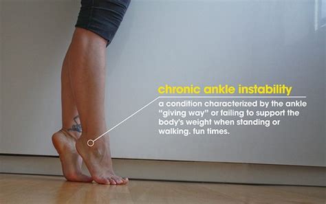 Ankle Instability Treating Chronic Instability Physiofit Physical