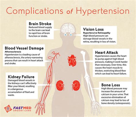 Imaging techniques are the cornerstone how should patients with secondary hypertension be managed? High Blood Pressure (Hypertension)