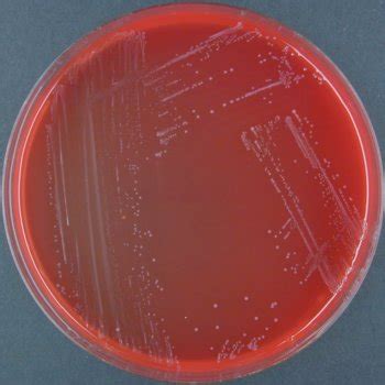 Listeria is known to veterinarians since the early 1900s all pathogenic strains of listeria (l. Listeria seeligeri