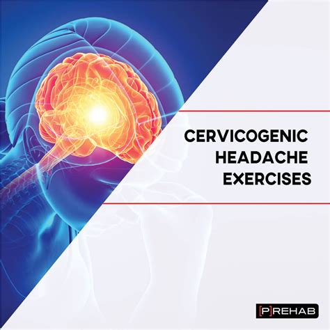 Cervicogenic Headache Exercises The Prehab Guys