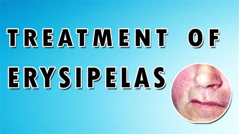 Erysipelas Treatment Symptoms And Rash Dermatology Course 5560