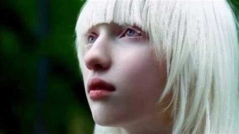 Most Beautiful People With Albinism Youtube