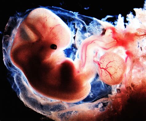 Discovering Something New Ongoing Learning Human Embryo At 6 Weeks
