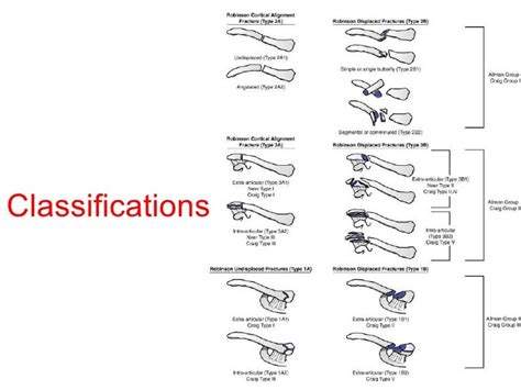 Clavicle Fracture Grading