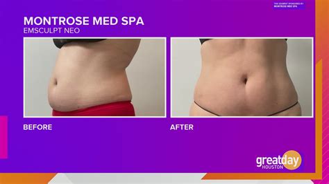 Sponsored: How Montrose Med Spa makes it easy to transform your face