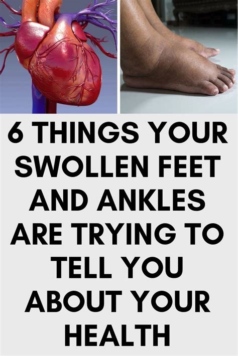 6 Things Your Swollen Feet And Ankles Are Trying To Tell You About Your