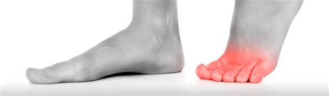 What Is Causing Your Toe Pain Achilles Podiatry