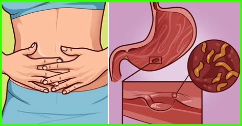 Of all the health topics cat owners consider, intestinal worms rarely make the list, especially if the cat stays in the home exclusively and never adventures outdoors. Natural Cures For Intestinal Parasites - toxoplasmosis