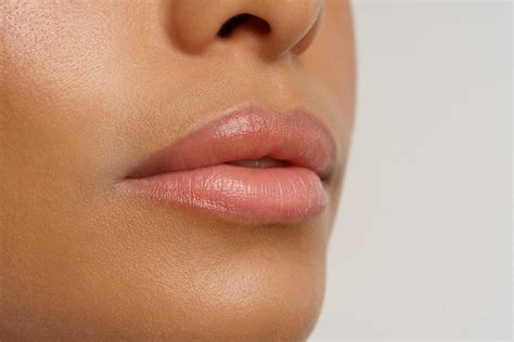 Botox Lip Flip How Long To See Results Michelle Esthetics