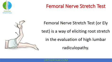 Femoral Nerve Stretch Test Orthofixar 2023