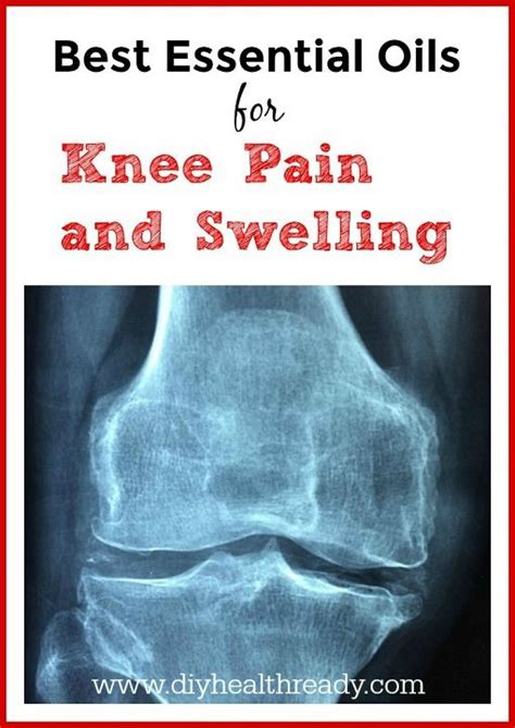 Knee Pain Its Easy To Learn How To Use These Best Essential Oils For