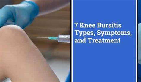 Types Of Knee Bursitis Symptoms Treatment More