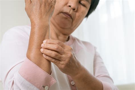 Senior Women Scratch Arm The Itch On Eczema Arm Healthcare And Medicine