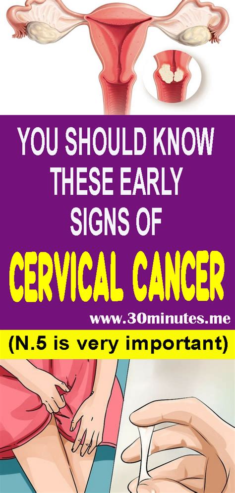 7 Warning Symptoms Of Cervical Cancer That Every Women Should Know