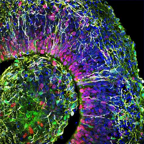 Human Cortical Organoids Model Neuronal Networks Brain Parts Stem Cell