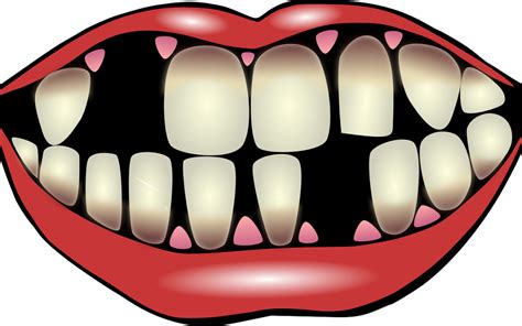 Dentist Clipart Lost Tooth Dentist Lost Tooth Transparent Free For