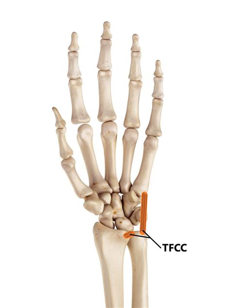 Tfcc Injuries My Family Physio