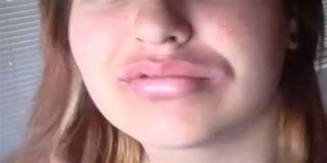 How To Make The Kylie Jenner Lip Challenge Go Away