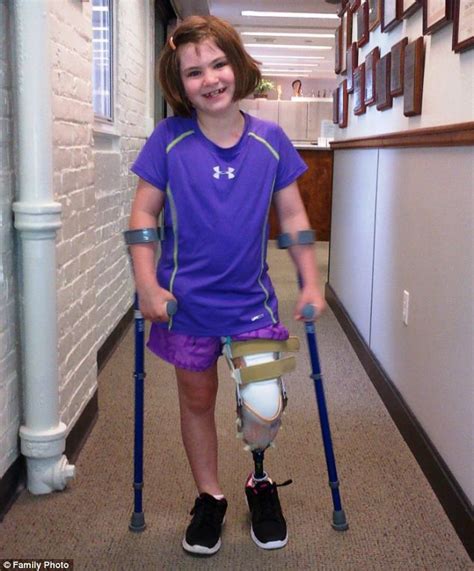 Jane Richard Shows Off Her New Prosthetic Leg After Boston Marathon Tragedy