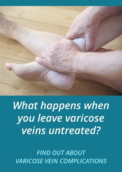 Venous Ulcers Untreated Varicose Vein Complications Vein Health