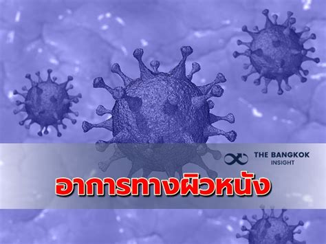 Check spelling or type a new query. สังเกตเพิ่ม! โควิด-19 ผิวหนังผิดปกติได้ด้วย - The Bangkok ...