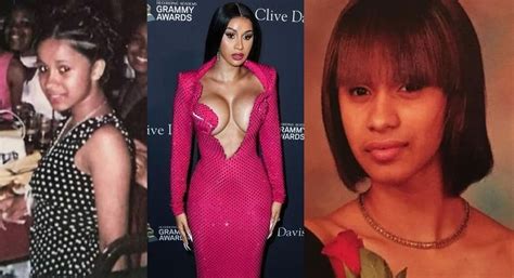 Cardi B Plastic Surgery Complete Details Cardi B Admitted She Got Plastic Surgery Before And