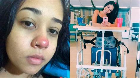 Jovens Perdem Movimentos Das Pernas Após Colocar Piercing E Espremer