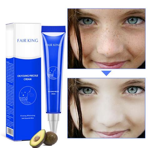 Buy Dark Spot Corrector Skin Whitening Fade Cream Lightening Blemish