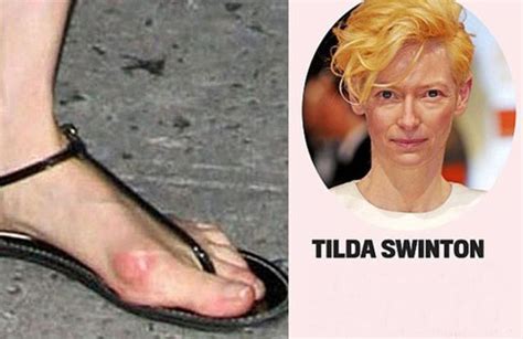 Beautiful Celebrities With Ugly Feet Funnymadworld