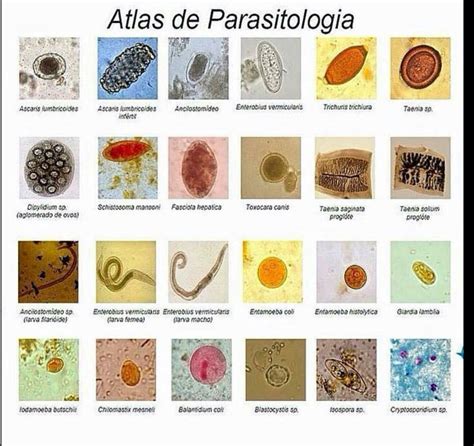 Pin By Kerollen Lopes On Biology Medical Laboratory Scientist Medical Laboratory Medical