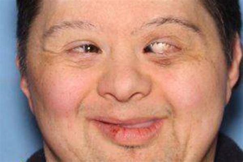 Update Police Locate Man With Down Syndrome Inside Car When It Was
